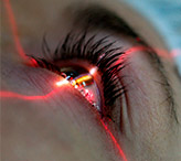 Последствия лазерной коррекции зрения
