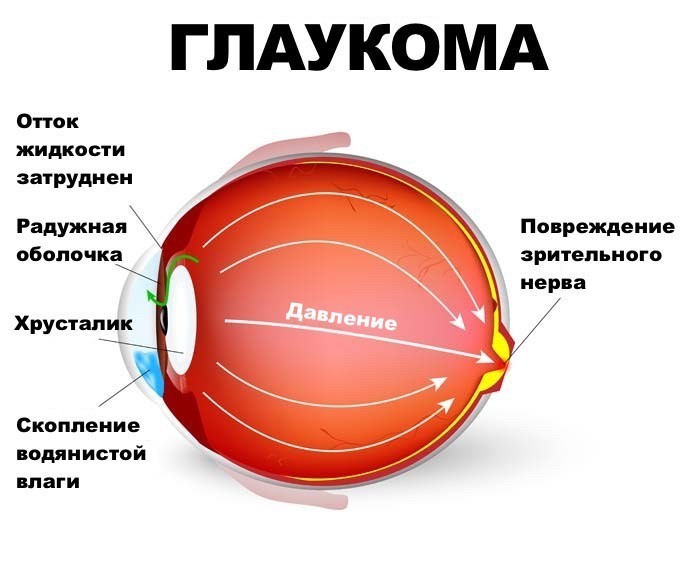 Информация о контактных линзах и очках
