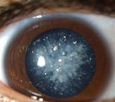 Норма глазного давления при глаукоме