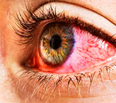 Заболевания век глаза